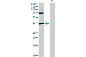Western Blot analysis of MEOX2 expression in transfected 293T cell line by MEOX2 MaxPab polyclonal antibody. (MEOX2 Antikörper  (AA 1-303))