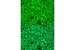 Immunofluorescence analysis of U2OS cells using NFKB2 antibody. (NFKB2 Antikörper  (AA 690-899))