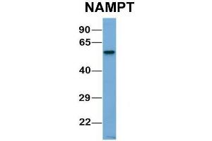 Host:  Rabbit  Target Name:  CHAD  Sample Type:  Human Adult Placenta  Antibody Dilution:  1. (NAMPT Antikörper  (C-Term))
