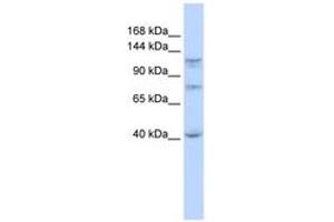Image no. 1 for anti-DEAH (Asp-Glu-Ala-His) Box Polypeptide 30 (DHX30) (N-Term) antibody (ABIN6742683) (DHX30 Antikörper  (N-Term))