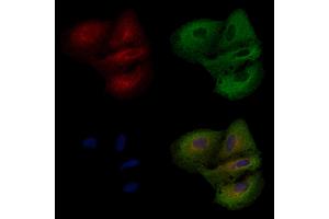 ABIN6258500 and ABIN6274589 staining  cells by IF/ICC. (ARRDC3 Antikörper  (C-Term))