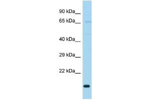 WB Suggested Anti-TIMM23B Antibody Titration: 1. (TIMM23B Antikörper  (N-Term))