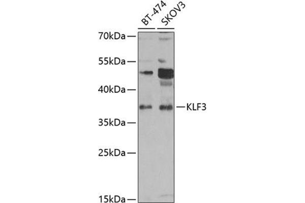 KLF3 Antikörper  (AA 1-240)