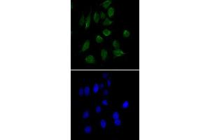 Immunofluorescence analysis of HeLa cells using CHD3 monoclonal antibody, clone 2G4  (green).