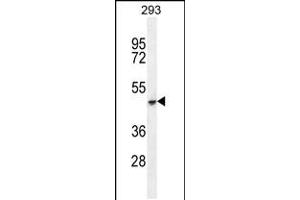 Western blot analysis in 293 cell line lysates (35ug/lane). (COCH Antikörper  (C-Term))