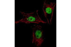 Immunofluorescence (IF) image for anti-Mesenchyme Homeobox 2 (MEOX2) antibody (ABIN3000188) (MEOX2 Antikörper)