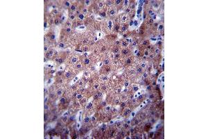 CYP2C19 Antibody (Center) (ABIN390665 and ABIN2840960) immunohistochemistry analysis in formalin fixed and paraffin embedded human liver tissue followed by peroxidase conjugation of the secondary antibody and DAB staining. (CYP2C19 Antikörper  (AA 257-285))