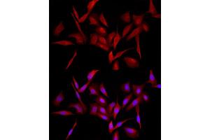 Immunofluorescence analysis of U2OS cells using MyD88 Rabbit pAb (ABIN3021213, ABIN3021214, ABIN3021215, ABIN1513232 and ABIN6214069) at dilution of 1:100 (40x lens). (MYD88 Antikörper  (AA 60-309))
