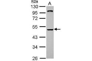 WB Image Sample (30 ug of whole cell lysate) A: HeLa 10% SDS PAGE antibody diluted at 1:5000 (Caspase 1 Antikörper)