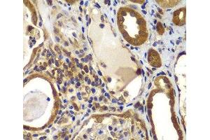 Immunohistochemistry of paraffin-embedded Human kidney using NME2 Polyclonal Antibody at dilution of 1:100 (40x lens). (NME2 Antikörper)