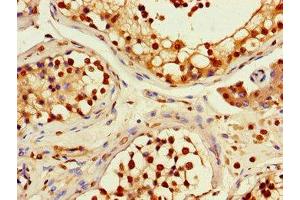 Immunohistochemistry of paraffin-embedded human testis tissue using ABIN7167735 at dilution of 1:100 (RFPL4B Antikörper  (AA 1-263))