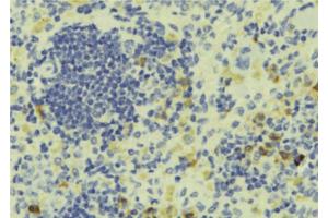ABIN6273302 at 1/100 staining Human lymph tissue by IHC-P. (PTP4A1 Antikörper  (C-Term))