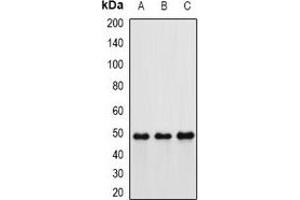 Western blot analysis of Hippi expression in MCF7 (A), mouse kidney (B), rat lung (C) whole cell lysates. (IFT57 Antikörper)