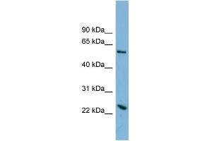 WB Suggested Anti-TMEM161A Antibody Titration:  0. (TMEM161A Antikörper  (Middle Region))