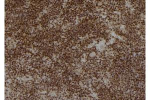 ABIN6259862 and ABIN6276876 at 1/100 staining Mouse spleen tissue by IHC-P.