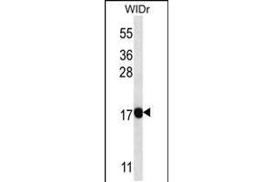 Western blot analysis in WiDr cell line lysates (35ug/lane). (PAEP Antikörper  (AA 73-101))