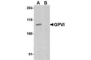 Image no. 1 for anti-Glycoprotein VI (Platelet) (GP6) (C-Term) antibody (ABIN342705)