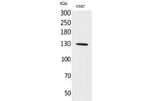 Western Blot analysis of K562 cells using Apaf-1 Polyclonal Antibody.