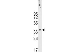 Western Blotting (WB) image for anti-Pancreatic and Duodenal Homeobox 1 (PDX1) antibody (ABIN3001419) (PDX1 Antikörper)