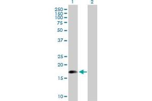 Western Blot analysis of ARL5A expression in transfected 293T cell line by ARL5A MaxPab polyclonal antibody. (ARL5A Antikörper  (AA 1-179))