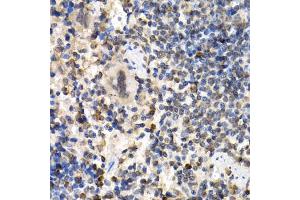 Immunohistochemistry of paraffin-embedded mouse spleen using RAD1 antibody (ABIN5995531) at dilution of 1/200 (40x lens).