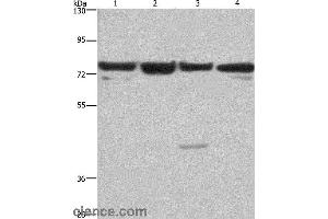 Western blot analysis of HUVEC, NIH/3T3, Hela and 293T cell, using KLF11 Polyclonal Antibody at dilution of 1:350 (KLF11 Antikörper)
