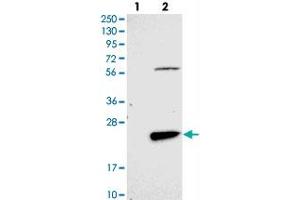 Western blot analysis of Lane 1: Negative control (vector only transfected HEK293T lysate), Lane 2: Over-expression Lysate (Co-expressed with a C-terminal myc-DDK tag (~3. (FAM167B Antikörper)
