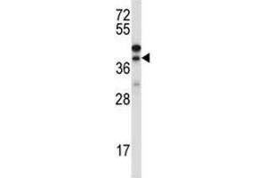 Western blot testing of CTGF antibody and NCI-H460 lysate (CTGF Antikörper  (AA 166-193))