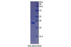 SDS-PAGE analysis of Cow MHCDRa Protein.