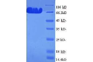 SDS-PAGE (SDS) image for tau Protein (AA 2-752) protein (His tag) (ABIN5709913) (tau Protein (AA 2-752) (His tag))