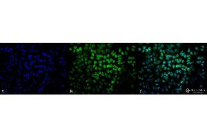 Immunocytochemistry/Immunofluorescence analysis using Rabbit Anti-TNF-R1 Polyclonal Antibody . (TNFRSF1A Antikörper  (AA 20-43) (FITC))