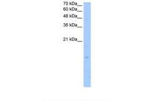 Image no. 1 for anti-Leukotriene C4 Synthase (LTC4S) (N-Term) antibody (ABIN341368) (LTC4S Antikörper  (N-Term))