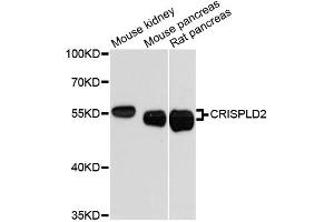 Western blot analysis of extracts of various cell lines, using CRISPLD2 antibody (ABIN6291926) at 1:3000 dilution. (CRISPLD2 Antikörper)