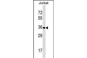 Western blot analysis in Jurkat cell line lysates (35ug/lane). (Uroplakin 3B Antikörper  (AA 192-219))