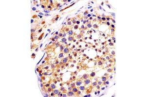 (ABIN6242987 and ABIN6578147) staining DYNC1H1 in human testis sections by Immunohistochemistry (IHC-P - paraformaldehyde-fixed, paraffin-embedded sections). (DYNC1H1 Antikörper  (C-Term))