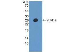 Detection of Recombinant LILRB2, Human using Polyclonal Antibody to Leukocyte Immunoglobulin Like Receptor Subfamily B, Member 2 (LILRB2) (LILRB2 Antikörper  (AA 53-255))