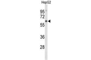 Western blot analysis of AFM Antibody (N-term) in HepG2 cell line lysates (35µg/lane). (Afamin Antikörper  (N-Term))