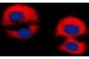 Immunofluorescent analysis of Dematin staining in Jurkat cells. (Dematin Antikörper  (C-Term))