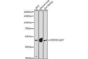 Western blot analysis of extracts of various cell lines, using CDKN1C/p57 Kip2 antibody (ABIN3022818, ABIN3022819, ABIN3022820, ABIN1512749 and ABIN6219243) at 1:1000 dilution. (CDKN1C Antikörper  (AA 1-100))