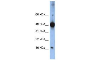 LSM4 antibody used at 1 ug/ml to detect target protein. (LSM4 Antikörper)