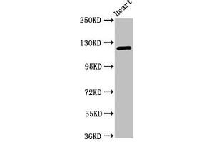Western Blot Positive WB detected in: Mouse heart tissue All lanes: SEMA5B antibody at 1 μg/mL Secondary Goat polyclonal to rabbit IgG at 1/50000 dilution Predicted band size: 126, 120, 124, 132 kDa Observed band size: 126 kDa