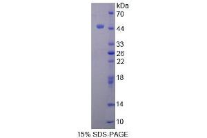 SDS-PAGE analysis of Human TTF1 Protein.
