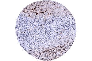 Cerebellum molecular layer Purkinje cell layer granule cell layer white matter A strong Calbindin 1 staining of Purkinje cells and of associated axonal fibres is seen in the cerebrum (CALB1 Antikörper  (AA 7-96))