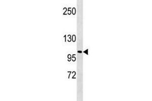LOXL2 antibody western blot analysis in A549 lysate. (LOXL2 Antikörper  (AA 589-617))