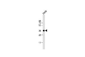 Anti-ARPC1A Antibody (C-term) at 1:1000 dilution + Hela whole cell lysate Lysates/proteins at 20 μg per lane. (ARPC1A Antikörper  (C-Term))