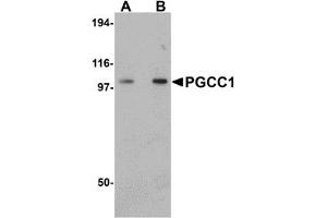 Western Blotting (WB) image for anti-Family with Sequence Similarity 120B (FAM120B) (C-Term) antibody (ABIN1030576) (FAM120B Antikörper  (C-Term))
