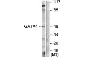 Western blot analysis of extracts from COLO205 cells, treated with Serum 20% 15', using GATA4 (Ab-262) Antibody. (GATA4 Antikörper  (AA 228-277))