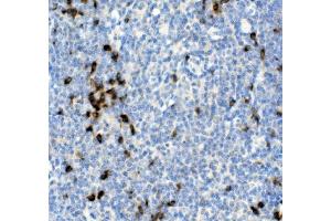IHC analysis of Cd79a using anti-Cd79a antibody (ABIN7601110).