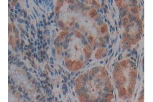 Used in DAB staining on fromalin fixed paraffin- embedded liver tissue (Thrombospondin 1 Antikörper  (AA 24-221))