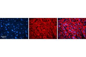 Rabbit Anti-alpha-DAG1 Antibody   Formalin Fixed Paraffin Embedded Tissue: Human heart Tissue Observed Staining: Cytoplasmic Primary Antibody Concentration: N/A Other Working Concentrations: 1:600 Secondary Antibody: Donkey anti-Rabbit-Cy3 Secondary Antibody Concentration: 1:200 Magnification: 20X Exposure Time: 0. (Dystroglycan Antikörper  (Middle Region))